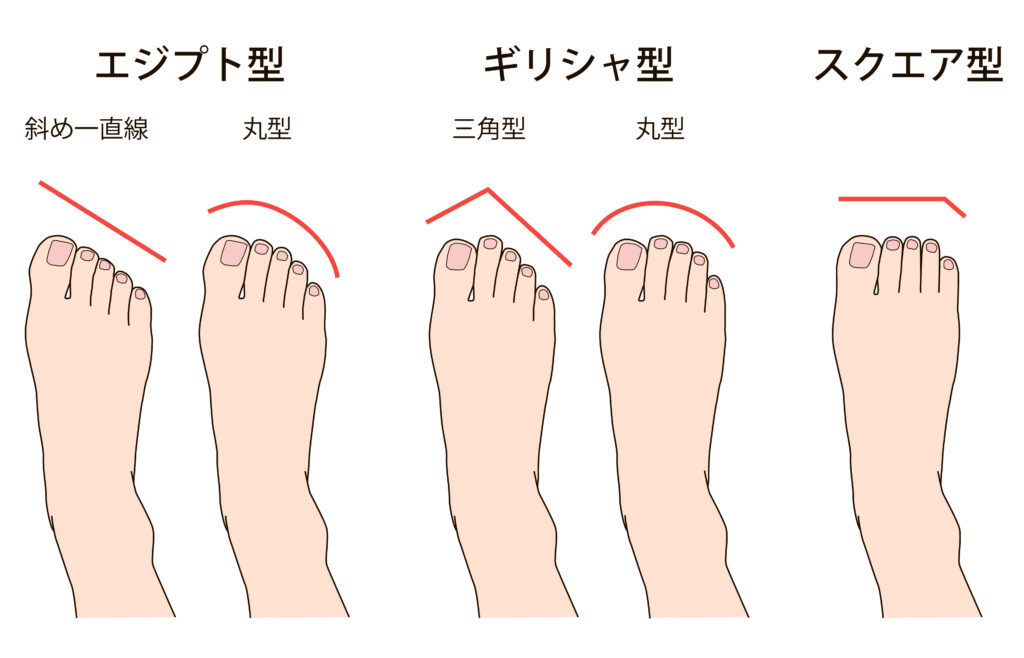 足の形の種類